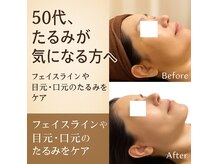 ドクターマジックタッチ(Dr.MAGIC TOUCH)の雰囲気(ブルドック顔・ほうれい線・二重アゴ付き過ぎた脂肪に脂肪分解)