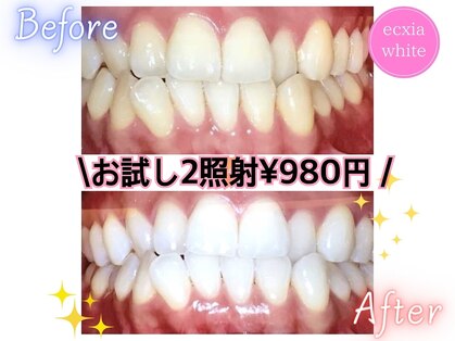 ルルネイル(Lulu Nail)の写真