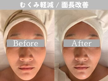 ミピマム 町田店/1回目から実感できる小顔サロン