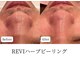 マテオ(Matteo)の写真