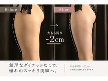 THE RESET private salon【10月上旬 NEW OPEN（予定）】の雰囲気（おすすめメニュー美脚、オイルマッサージ）