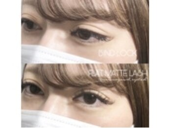 リゴレット(RIGOLETTO)/＊バインドロック