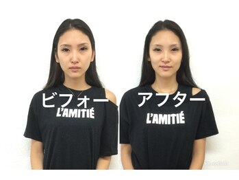 ビューティスタジオＫ/小顔矯正ビフォーアフター