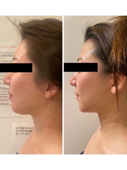 ルナグランデ(Luna grande.)/結果出しに自信あります!