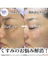 エリス(ELISSE)/フェイシャルワックス