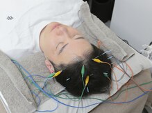 マカナ接骨院(Makana接骨院)/電気を流す頭皮鍼