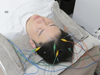 マカナ接骨院(Makana接骨院)/電気を流す頭皮鍼