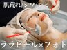 【初回体験】夏の紫外線に ララピール×フォト 肌荒れ/シミ ￥15000→￥12000