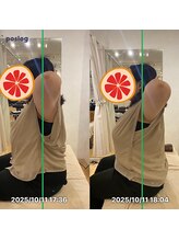 グレフル鍼灸接骨院 整体院 心斎橋/整体/肩こり/マッサージ/腰痛