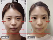 さつま骨格矯正 表参道青山院/歪み小顔矯正＋骨盤矯正