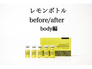 クリニカルエステ イーズ あべのキューズタウン店/イーズ全国の喜びの変化!!!