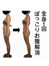 スピード美人 新宿店/スライドカッピング全身1回