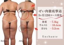 アンシャンテ(Enchante)