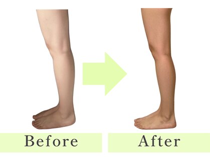 ヨサパーク トゥインクル(YOSAPARK twinkle)の写真