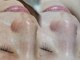 エスポワール(ESPOIR)の写真/理想の素肌へ導く!フェイシャルメニューの組み合わせで、あなただけのケアナキレイを実感◎