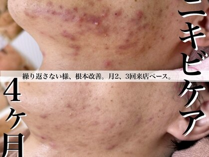 ヴェアリー 広尾(VARY)の写真