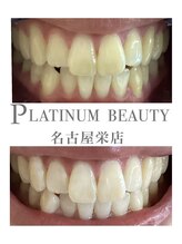 プラチナムビューティー 名古屋栄本店(PLATINUM BEAUTY)/お客様Before After