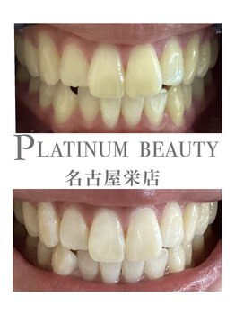 プラチナムビューティー 名古屋栄本店(PLATINUM BEAUTY)/お客様Before After