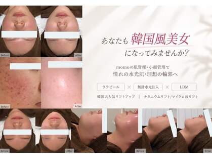 モモ(momo)の写真