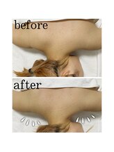 エクスクラメーションマーク(!!!)/肩★もっこりさよなら＾＾