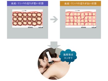 エスペランサ 高崎店(ESPERANZA)/最新ハイパーナイフ６　痩身