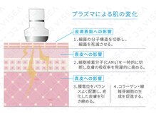 ミウ(MIU)/プラズマの効果