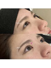 ミリ 奈良駅店(mm)/beforeafter！