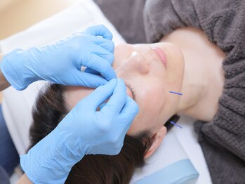 えりこ鍼灸治療室