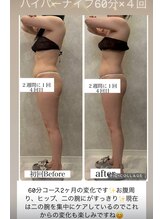 レイ(Ray)/ハイパーナイフ60分コース