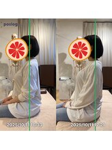 グレフル鍼灸接骨院 整体院 心斎橋/整体/肩こり/マッサージ/腰痛