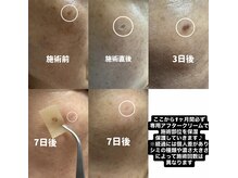 メイリー(Maylie)/WHITELABモニター/石巻メイリー