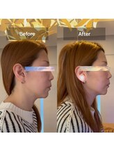 アールズ(R's)/フェイシャル