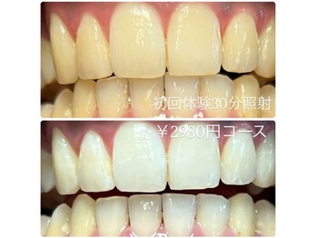 ホワイトニングルーム 横浜店(Whitening Room)/セルフホワイトニング/横浜