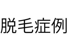 メンズ asc(men's asc)/症例：脱毛