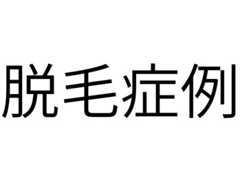 メンズ asc(men's asc)/症例：脱毛