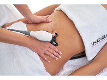 インドエステ アロマヒーリング 中目黒店/インディバ施術/深部加温　妊活