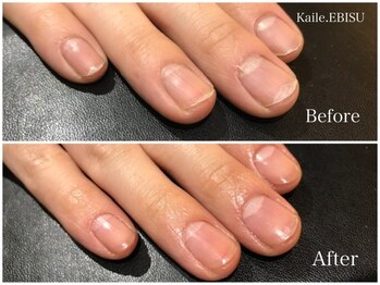 カイル 恵比寿(Kaile.)/メンズケア