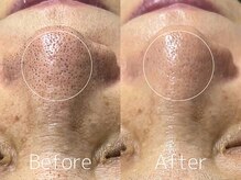 マイナプラ 表参道(myna+)/