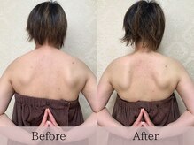 フローラ(FLORA)/天使の羽美ボディリンパ