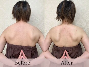 フローラ(FLORA)/天使の羽美ボディリンパ