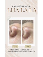 モモ(momo)/肌で見た目年齢は変化する！