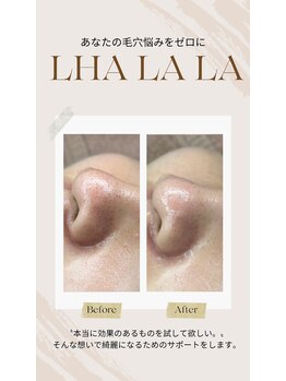 モモ(momo)/肌で見た目年齢は変化する！