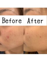 グレイス(Grace)/