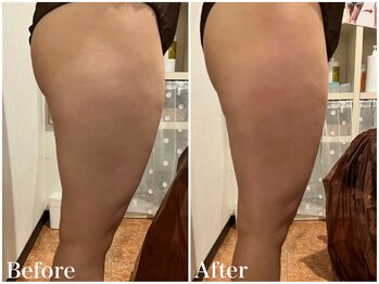 サロンドフェイス(Salon de Faith)/【ラジオ波】6回施術♪