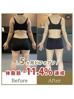 ワナ(WANNA)/40代女性のビフォーアフター