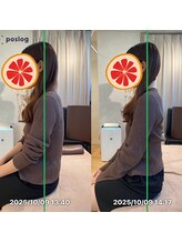 グレフル鍼灸接骨院 整体院 心斎橋/整体/肩こり/マッサージ/腰痛