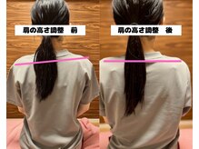 美容整体　姿勢改善　巻き肩　背中歪み　