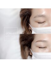 リヨン(LYON+831)/