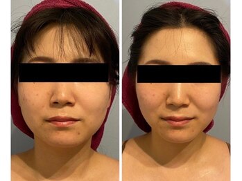 ルナグランデ(Luna grande.)/輪郭ハッキリ!