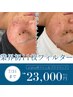 顧客人気No.2【最高峰シミケア/ニキビケア特化】光フェイシャル&プラズマ